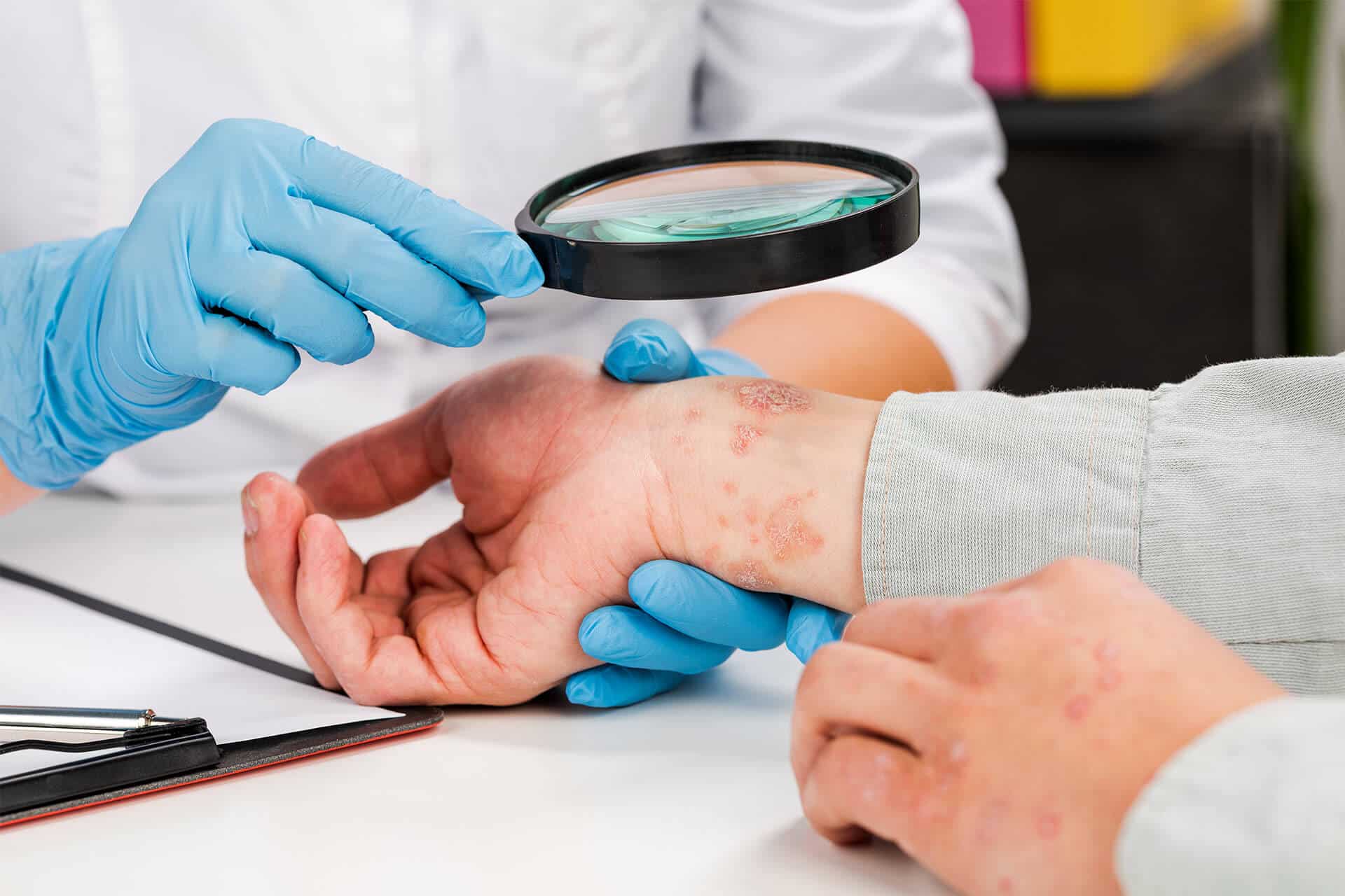 Dermatologist in Bensalem performing a skin exam on a patients hand