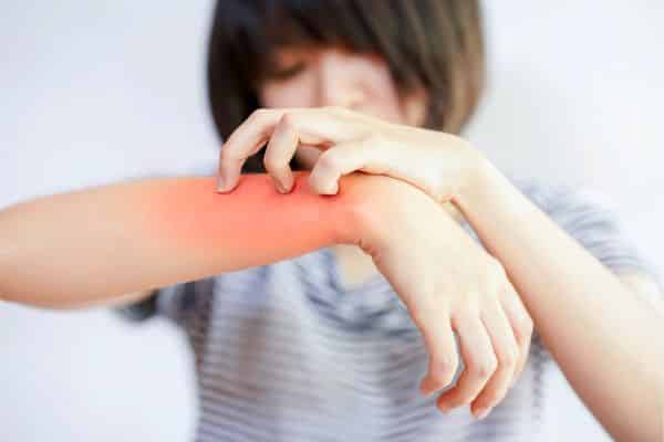 Autoimmune Skin Condition Treatment